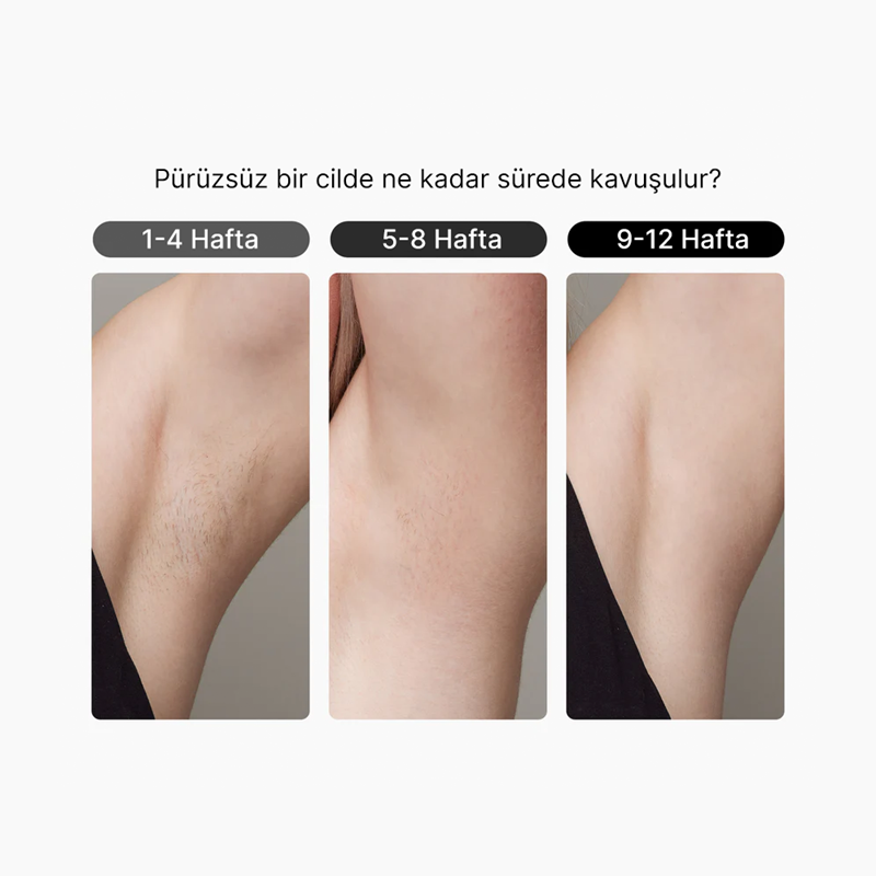 Ulike Air 3 IPL Mor Lazer Epilasyon Aleti